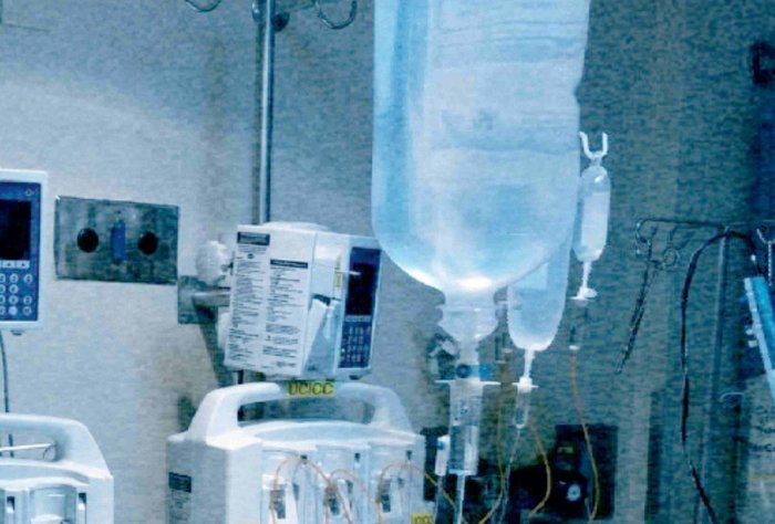 Reposición con Fluidos en el Paciente Crítico