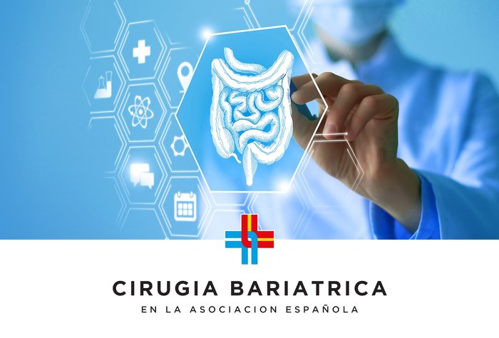 Cirugía Bariátrica en la Asociación Española